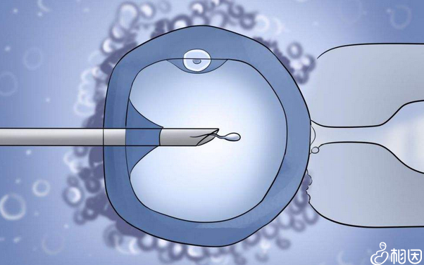 美国生子费用预算分析