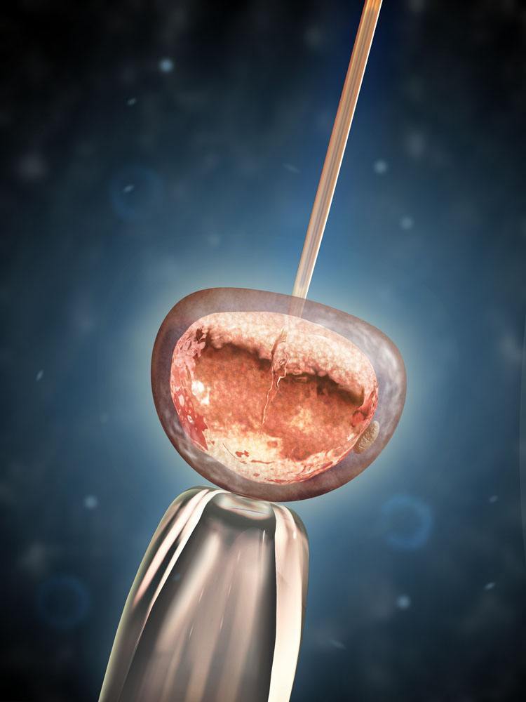 美国试管医院成功率排名分析
