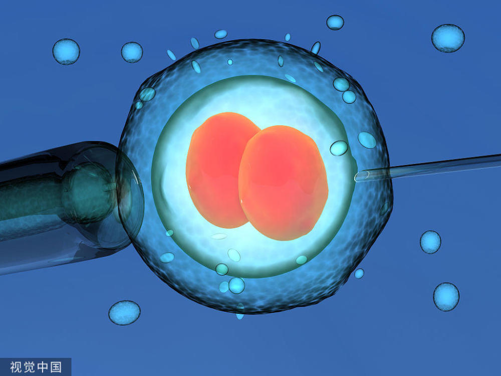 羊水穿刺术产前诊断